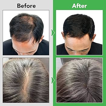 Faith in Herbal Anti-Dandruff & Hair Growth Shampoo + Conditioner (200ml)