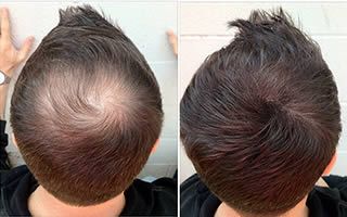 Faith in Herbal Anti-Dandruff & Hair Growth Shampoo + Conditioner (200ml)