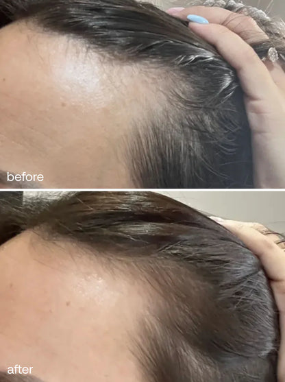 Faith in Herbal Anti-Dandruff & Hair Growth Shampoo + Conditioner (200ml)