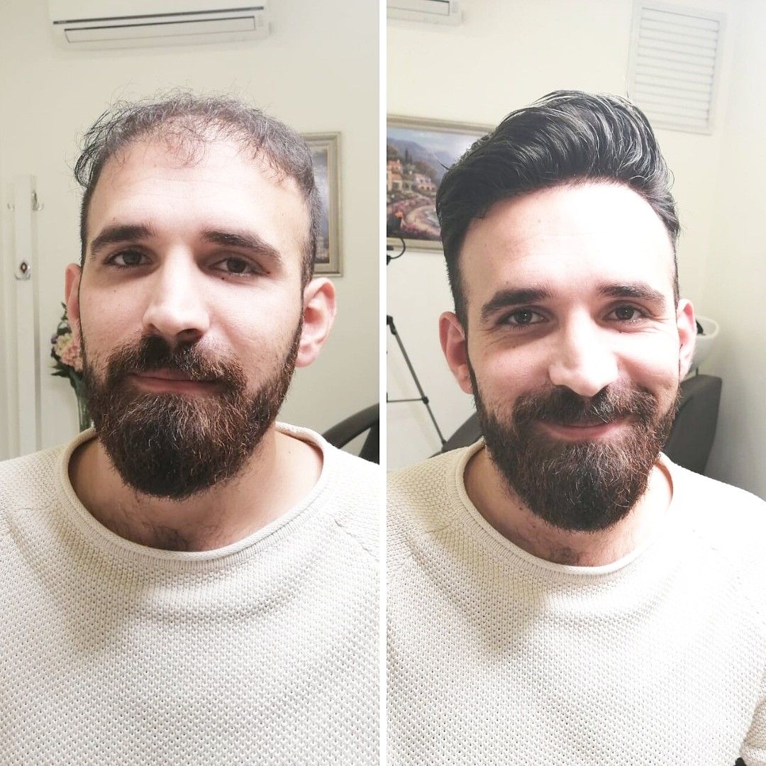 Faith in Herbal Anti-Dandruff & Hair Growth Shampoo + Conditioner (200ml)