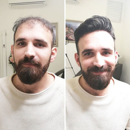 Faith in Herbal Anti-Dandruff & Hair Growth Shampoo + Conditioner (200ml)